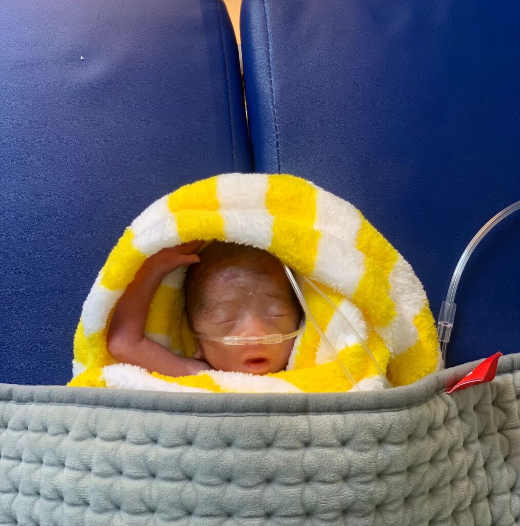 Neonate wrapped in white and yellow striped towel